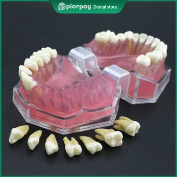 PIORPOY Dental Teach Стандартная модель M7008, Демонстрационная модель зубов, Съемные зубы для изучения стоматологии, инструмент для дропшиппинга